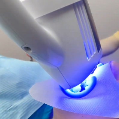 Отбеливание на Beyond в клинике